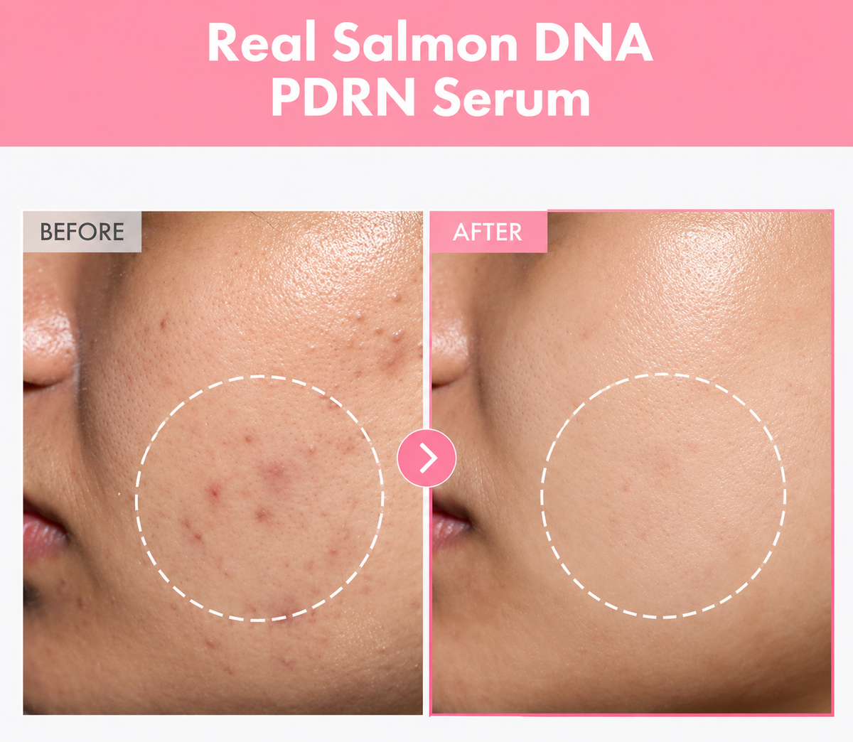 Sérum Pink Peptide PDRN TOSOWOONG 33ml